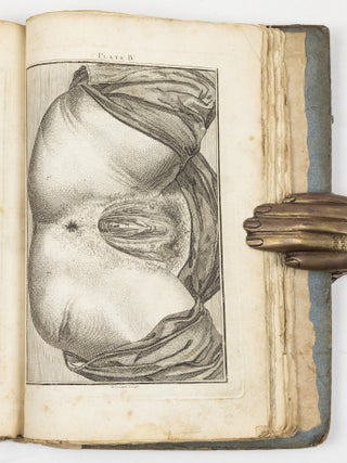 A set of anatomical tables, with explanations, and an abridgment of the practice of midwifery; with a view to illustrate a Treatise on that Subject, and Collection of Cases, By William Smellie, M.D.