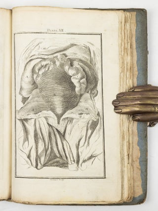 A set of anatomical tables, with explanations, and an abridgment of the practice of midwifery; with a view to illustrate a Treatise on that Subject, and Collection of Cases, By William Smellie, M.D.
