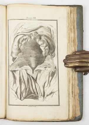 A set of anatomical tables, with explanations, and an abridgment of the practice of midwifery; with a view to illustrate a Treatise on that Subject, and Collection of Cases, By William Smellie, M.D.