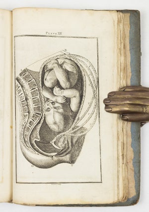 A set of anatomical tables, with explanations, and an abridgment of the practice of midwifery; with a view to illustrate a Treatise on that Subject, and Collection of Cases, By William Smellie, M.D.