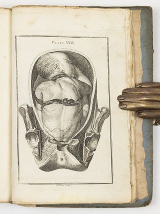 A set of anatomical tables, with explanations, and an abridgment of the practice of midwifery; with a view to illustrate a Treatise on that Subject, and Collection of Cases, By William Smellie, M.D.
