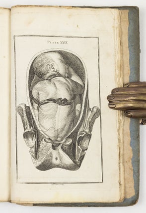 A set of anatomical tables, with explanations, and an abridgment of the practice of midwifery; with a view to illustrate a Treatise on that Subject, and Collection of Cases, By William Smellie, M.D.