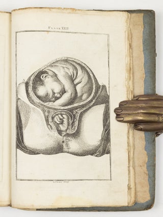 A set of anatomical tables, with explanations, and an abridgment of the practice of midwifery; with a view to illustrate a Treatise on that Subject, and Collection of Cases, By William Smellie, M.D.