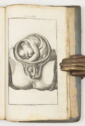 A set of anatomical tables, with explanations, and an abridgment of the practice of midwifery; with a view to illustrate a Treatise on that Subject, and Collection of Cases, By William Smellie, M.D.