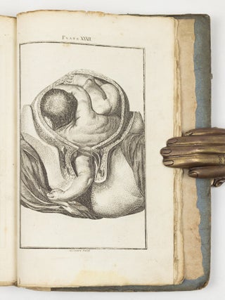 A set of anatomical tables, with explanations, and an abridgment of the practice of midwifery; with a view to illustrate a Treatise on that Subject, and Collection of Cases, By William Smellie, M.D.