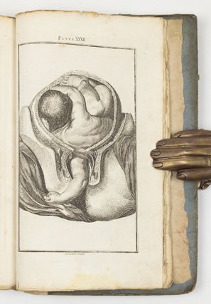 A set of anatomical tables, with explanations, and an abridgment of the practice of midwifery; with a view to illustrate a Treatise on that Subject, and Collection of Cases, By William Smellie, M.D.