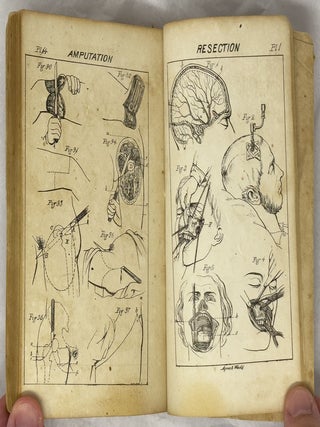 A manual of military surgery.