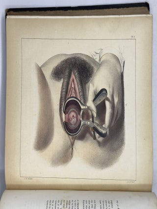 Illustrations of syphilitic disease. . . with the addition of a history of syphilis, and a complete bibliography and formulary of remedies. . . With Fifty Large Quarto Plates comprising one hundred and seventeen beautifully colored illustrations