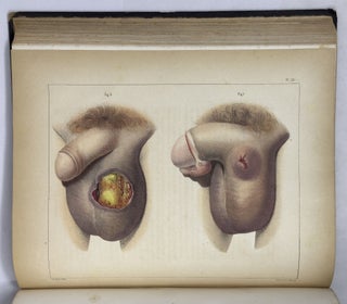 Illustrations of syphilitic disease. . . with the addition of a history of syphilis, and a complete bibliography and formulary of remedies. . . With Fifty Large Quarto Plates comprising one hundred and seventeen beautifully colored illustrations