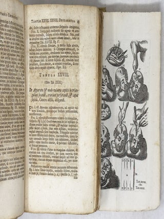 Joannis Sculteti Physici Ulmensis olim felicissimi Armamentarium Chirurgicum, Olim auctum Triginta novem Tabulis, tam veteres quam recentiores machines & operationes exhibentibus; Nec non observationum medico-chirurgicarum centuria collecta a Joh. Baptista a Lamzweerde, Ph. & Med. Doct. & observationibus Petri Hadriani F. Verduin, Studio Johannis Tilingii M. D. editis. Nunc vero In meliorem ordinem redactum, ab innumeris mendis expurgatum, & locupletissimo indice provisum studio Johan. Christophori de Spr&ouml;gel, Med. Doc. & Membri Acad. Nat. Curios. Nymphodorus dicti