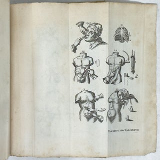 Joannis Sculteti Physici Ulmensis olim felicissimi Armamentarium Chirurgicum, Olim auctum Triginta novem Tabulis, tam veteres quam recentiores machines & operationes exhibentibus; Nec non observationum medico-chirurgicarum centuria collecta a Joh. Baptista a Lamzweerde, Ph. & Med. Doct. & observationibus Petri Hadriani F. Verduin, Studio Johannis Tilingii M. D. editis. Nunc vero In meliorem ordinem redactum, ab innumeris mendis expurgatum, & locupletissimo indice provisum studio Johan. Christophori de Sprögel, Med. Doc. & Membri Acad. Nat. Curios. Nymphodorus dicti