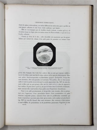 Atlas d'ophthalmoscopie m&eacute;dicale et de c&eacute;r&eacute;broscopie montrant chez l'homme et chez les animaux les l&eacute;sions du nerf optique, de la r&eacute;tine et de la choro&iuml;de produites par les maladies du cerveau, par les maladies de la moelle &eacute;pin&egrave;re et par les maladies constitutionelles et humorales. . .