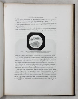 Atlas d'ophthalmoscopie médicale et de cérébroscopie montrant chez l'homme et chez les animaux les lésions du nerf optique, de la rétine et de la choroïde produites par les maladies du cerveau, par les maladies de la moelle épinère et par les maladies constitutionelles et humorales. . .