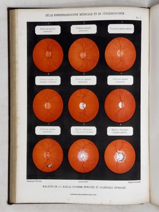 Atlas d'ophthalmoscopie m&eacute;dicale et de c&eacute;r&eacute;broscopie montrant chez l'homme et chez les animaux les l&eacute;sions du nerf optique, de la r&eacute;tine et de la choro&iuml;de produites par les maladies du cerveau, par les maladies de la moelle &eacute;pin&egrave;re et par les maladies constitutionelles et humorales. . .