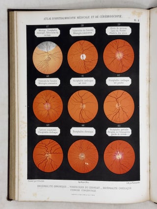 Atlas d'ophthalmoscopie m&eacute;dicale et de c&eacute;r&eacute;broscopie montrant chez l'homme et chez les animaux les l&eacute;sions du nerf optique, de la r&eacute;tine et de la choro&iuml;de produites par les maladies du cerveau, par les maladies de la moelle &eacute;pin&egrave;re et par les maladies constitutionelles et humorales. . .