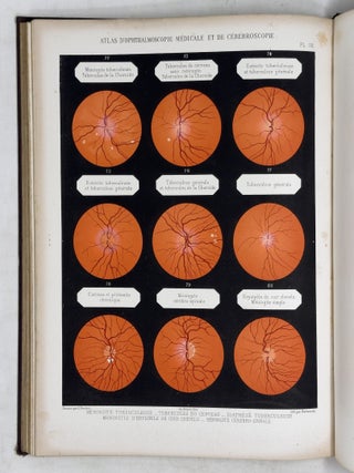 Atlas d'ophthalmoscopie m&eacute;dicale et de c&eacute;r&eacute;broscopie montrant chez l'homme et chez les animaux les l&eacute;sions du nerf optique, de la r&eacute;tine et de la choro&iuml;de produites par les maladies du cerveau, par les maladies de la moelle &eacute;pin&egrave;re et par les maladies constitutionelles et humorales. . .