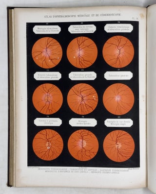Atlas d'ophthalmoscopie médicale et de cérébroscopie montrant chez l'homme et chez les animaux les lésions du nerf optique, de la rétine et de la choroïde produites par les maladies du cerveau, par les maladies de la moelle épinère et par les maladies constitutionelles et humorales. . .