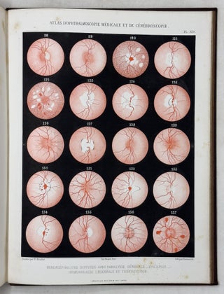 Atlas d'ophthalmoscopie médicale et de cérébroscopie montrant chez l'homme et chez les animaux les lésions du nerf optique, de la rétine et de la choroïde produites par les maladies du cerveau, par les maladies de la moelle épinère et par les maladies constitutionelles et humorales. . .